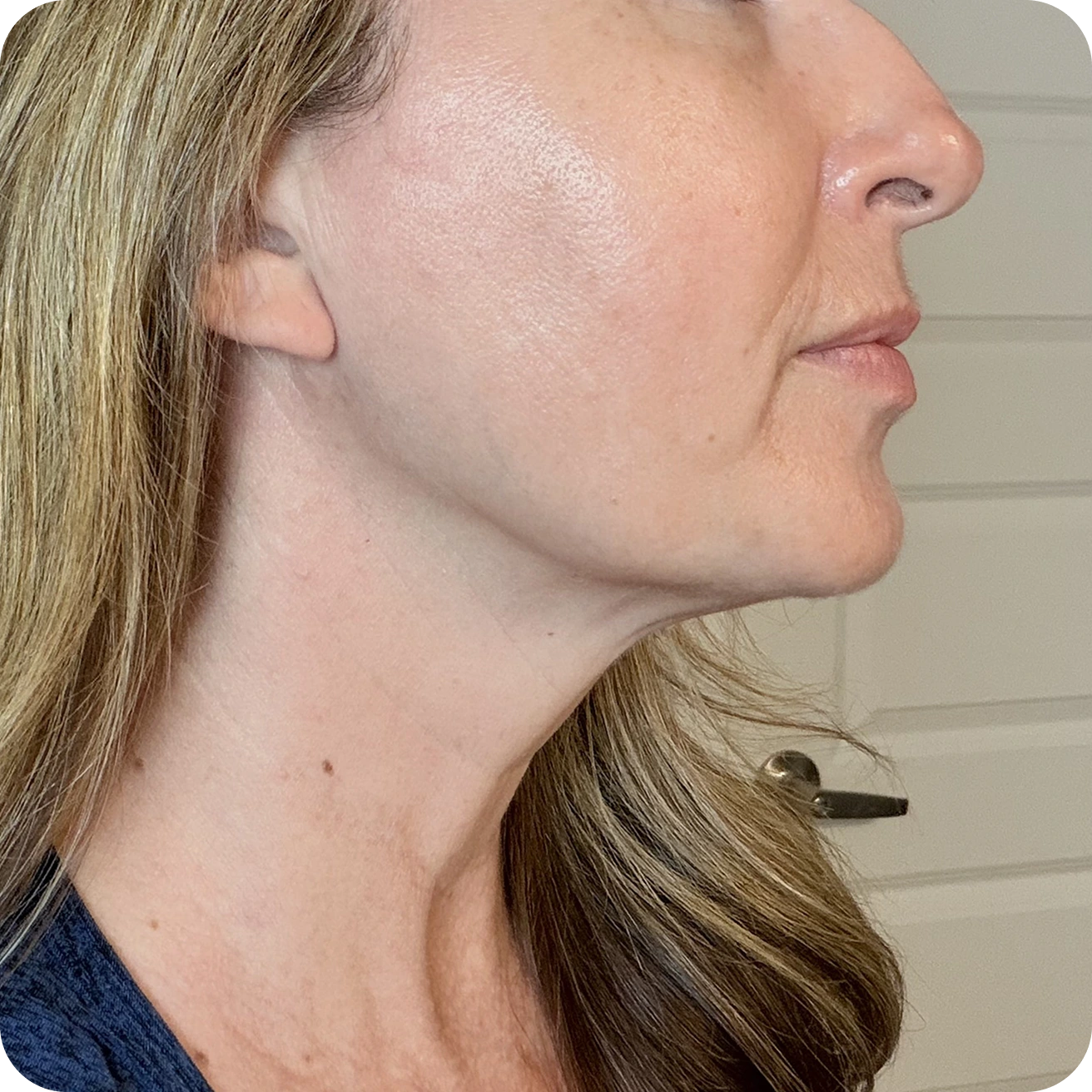 Why This Mask Works Beyond the Surface