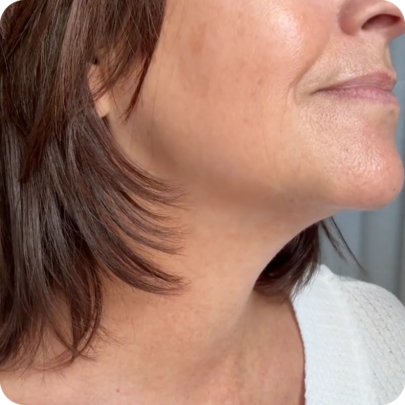 The $26 Alternative to $1,000 Treatments